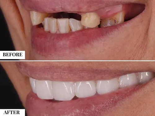 Cosmetic dentistry smile
